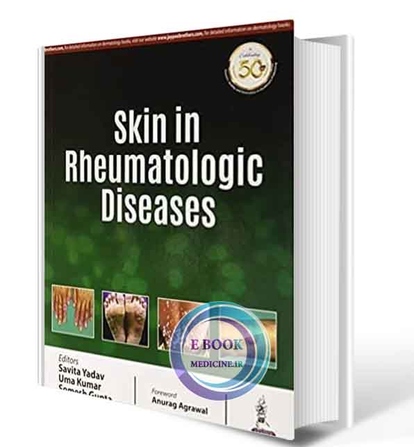 دانلود کتاب Skin In Rheumatologic Diseases    2021 (ORIGINAL PDF)